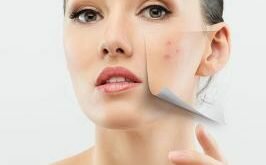 Последствия праздничного застолья: восстанавливаем кожу лица