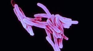 Найдена молекула туберкулеза, вызывающая кашель